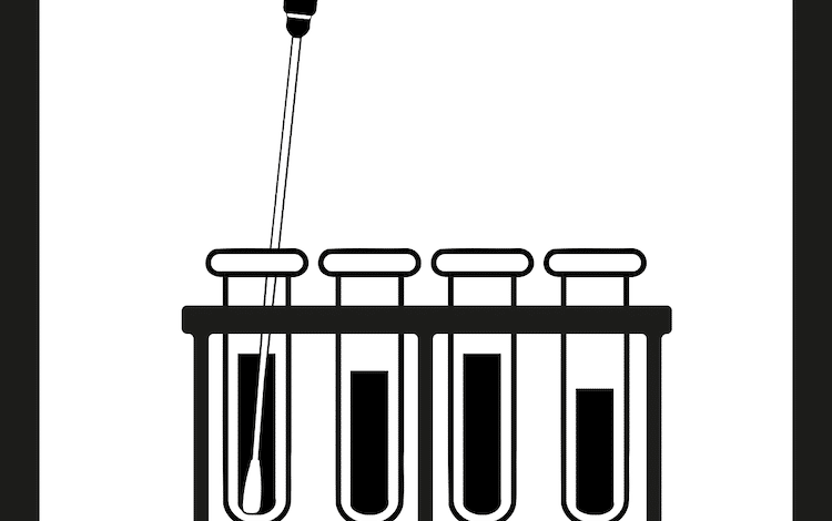 2021-03-11-Schnelltests-Schnelltest